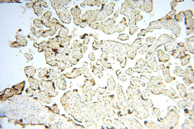 MCL1L Antibody in Immunohistochemistry (Paraffin) (IHC (P))