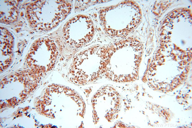 MCL1L Antibody in Immunohistochemistry (Paraffin) (IHC (P))