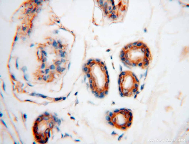 GARS Antibody in Immunohistochemistry (Paraffin) (IHC (P))