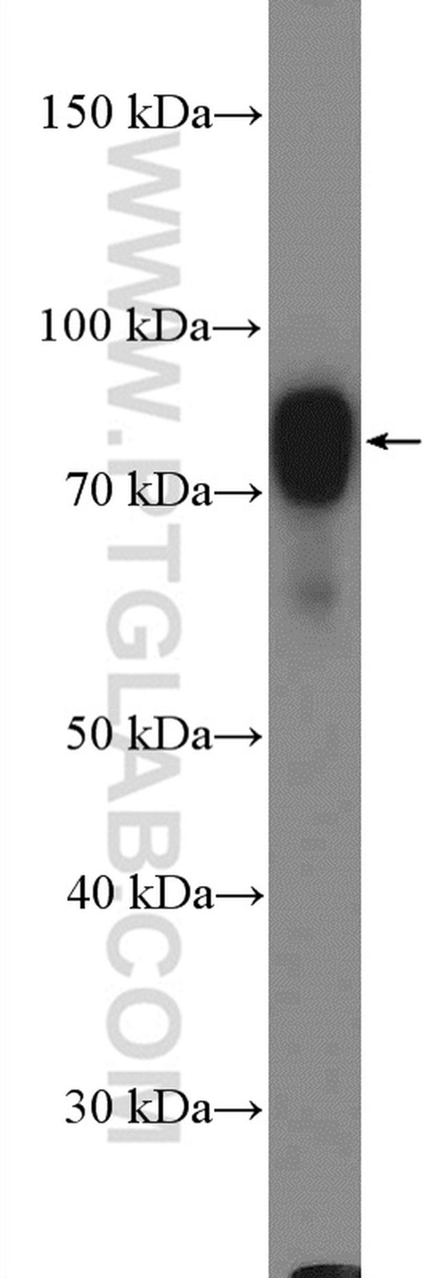 GARS Antibody in Western Blot (WB)