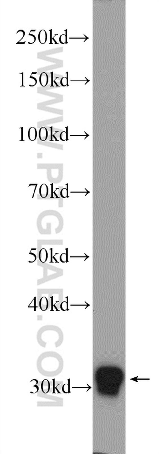 FOSL2 Antibody in Western Blot (WB)