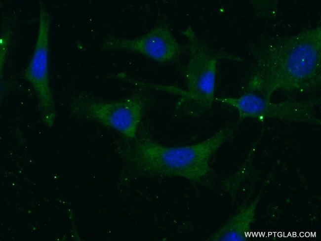 Vitronectin Antibody in Immunocytochemistry (ICC/IF)