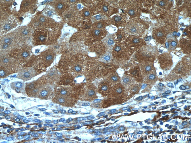 Vitronectin Antibody in Immunohistochemistry (Paraffin) (IHC (P))