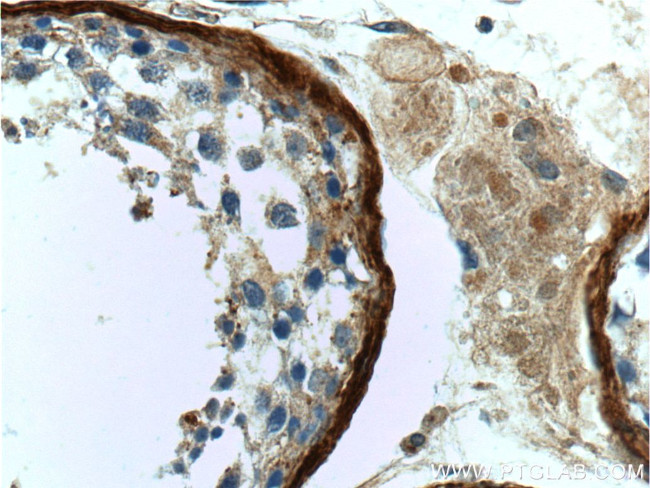 Vitronectin Antibody in Immunohistochemistry (Paraffin) (IHC (P))