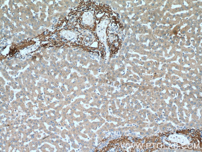 Vitronectin Antibody in Immunohistochemistry (Paraffin) (IHC (P))