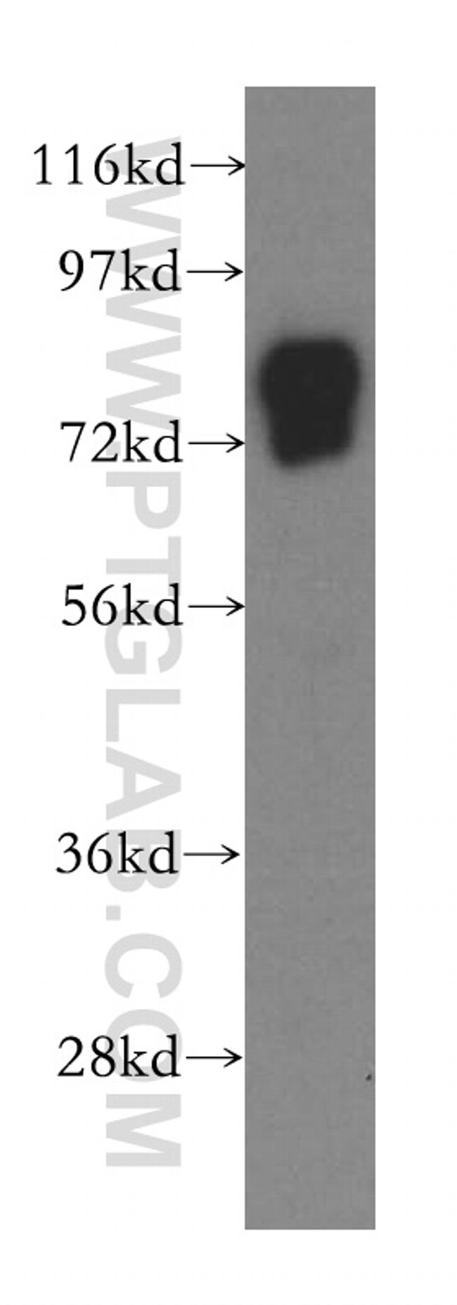 Vitronectin Antibody in Western Blot (WB)