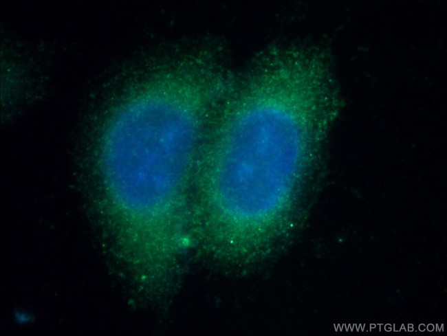 C4BPB Antibody in Immunocytochemistry (ICC/IF)