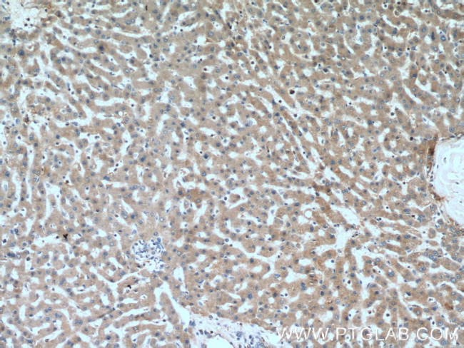 C4BPB Antibody in Immunohistochemistry (Paraffin) (IHC (P))