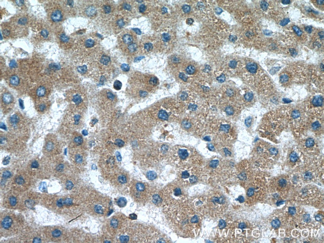 C4BPB Antibody in Immunohistochemistry (Paraffin) (IHC (P))