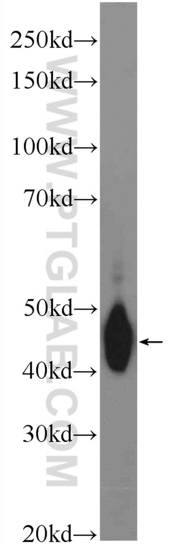 C4BPB Antibody in Western Blot (WB)