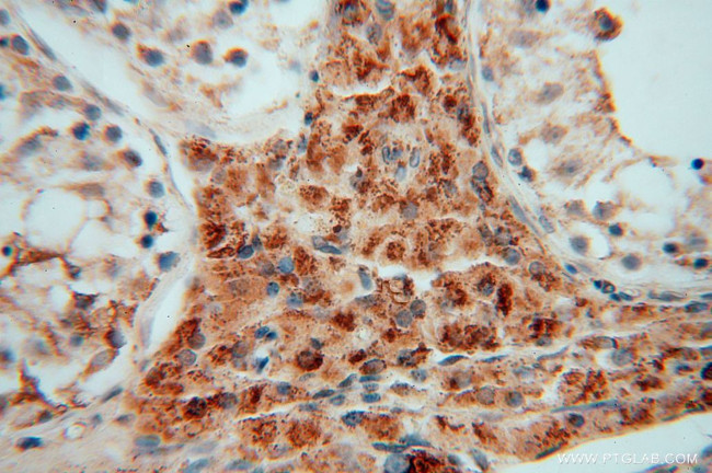 GSTT1 Antibody in Immunohistochemistry (Paraffin) (IHC (P))