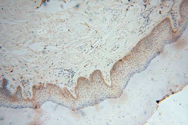 GSTT1 Antibody in Immunohistochemistry (Paraffin) (IHC (P))