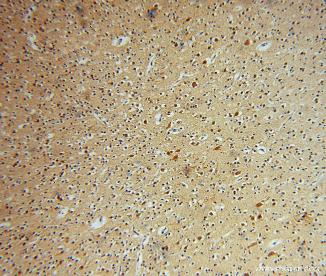 GSTT1 Antibody in Immunohistochemistry (Paraffin) (IHC (P))