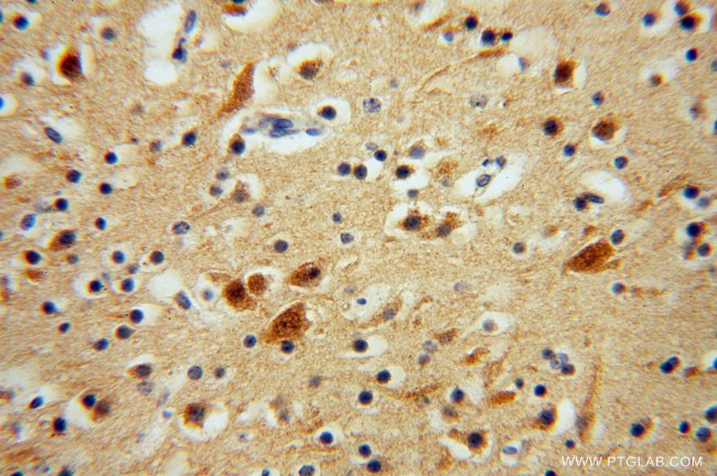 GSTT1 Antibody in Immunohistochemistry (Paraffin) (IHC (P))