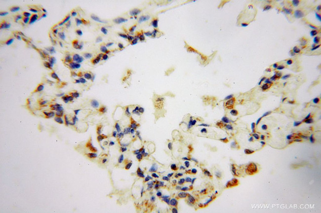 GSTT1 Antibody in Immunohistochemistry (Paraffin) (IHC (P))