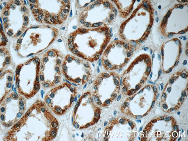 GSTT1 Antibody in Immunohistochemistry (Paraffin) (IHC (P))