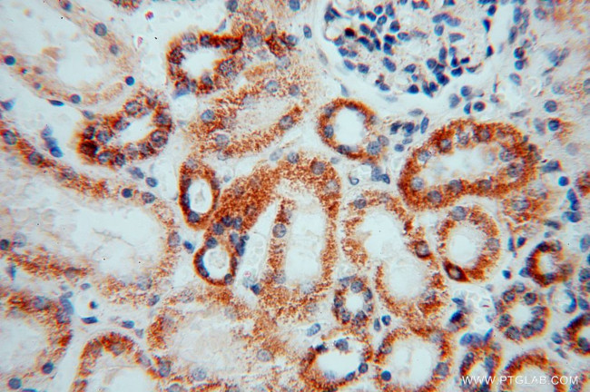 GSTT1 Antibody in Immunohistochemistry (Paraffin) (IHC (P))