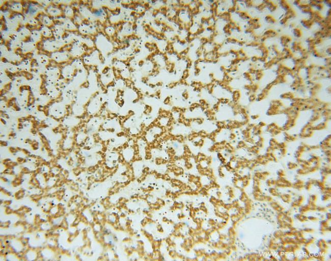 GSTT1 Antibody in Immunohistochemistry (Paraffin) (IHC (P))