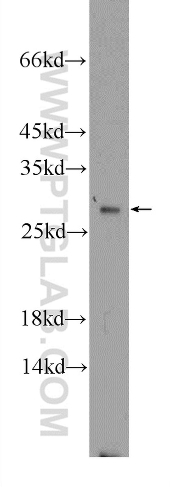 GSTT1 Antibody in Western Blot (WB)