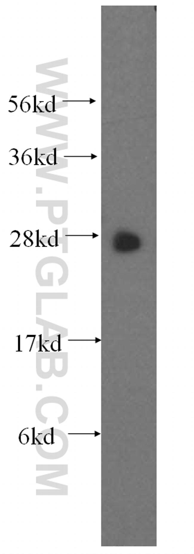 GSTT1 Antibody in Western Blot (WB)