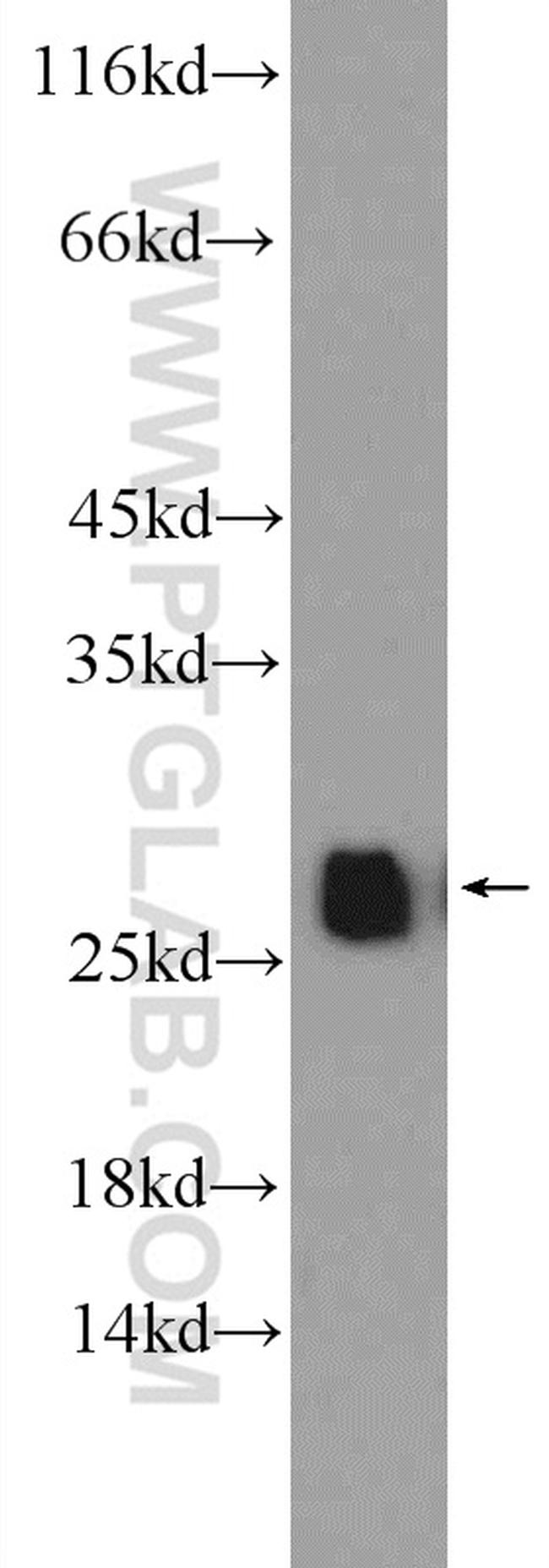 GSTT1 Antibody in Western Blot (WB)