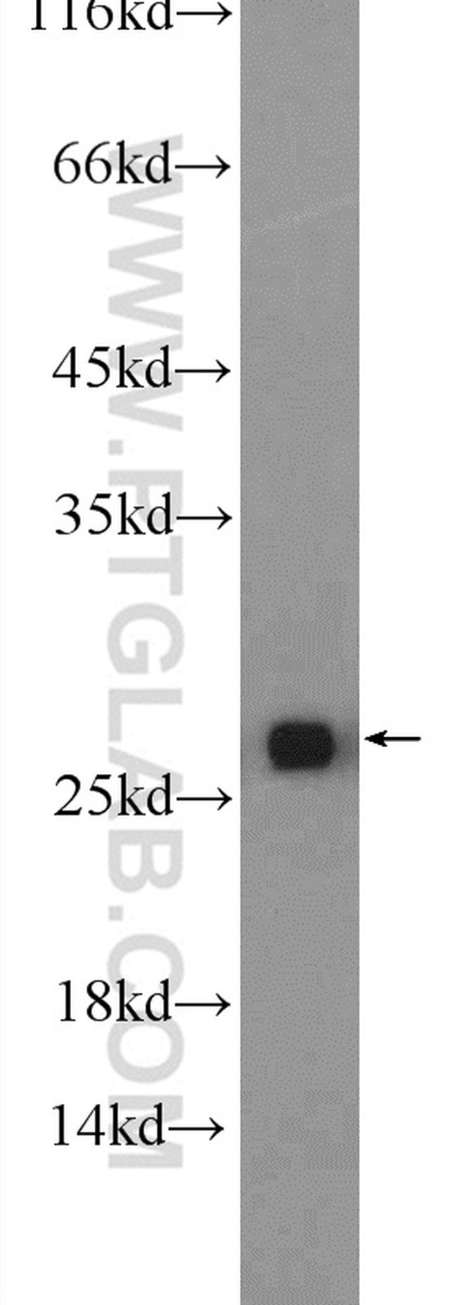 GSTT1 Antibody in Western Blot (WB)