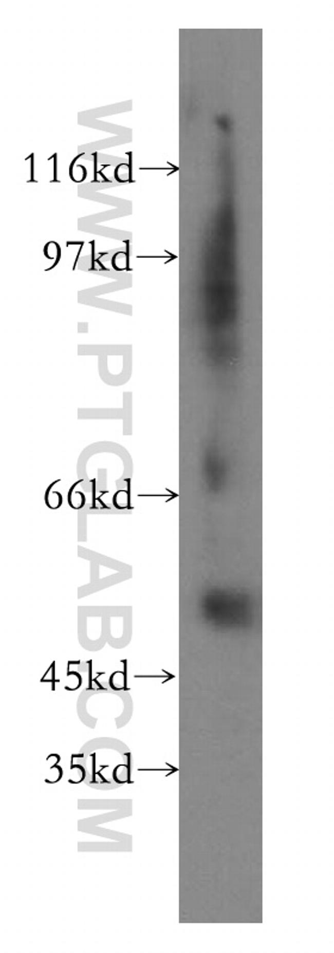 Fibrinogen gamma chain Antibody in Western Blot (WB)