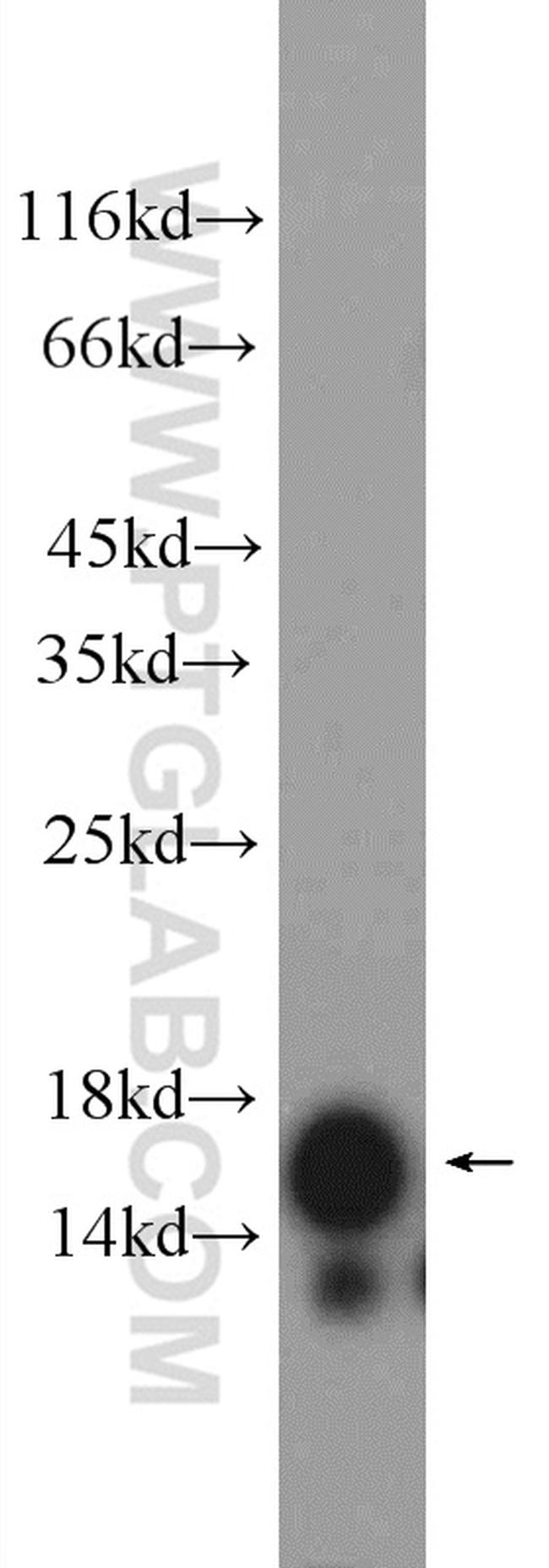 PLA2G1B Antibody in Western Blot (WB)