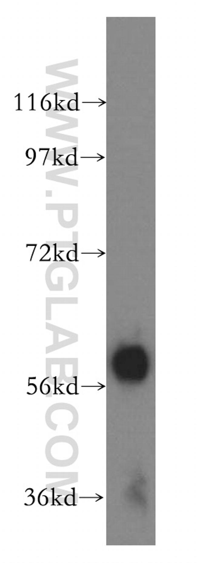 Amylase alpha Antibody in Western Blot (WB)