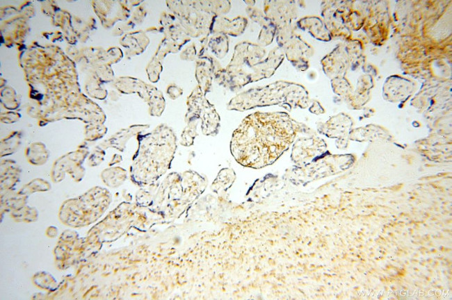 TGM4 Antibody in Immunohistochemistry (Paraffin) (IHC (P))