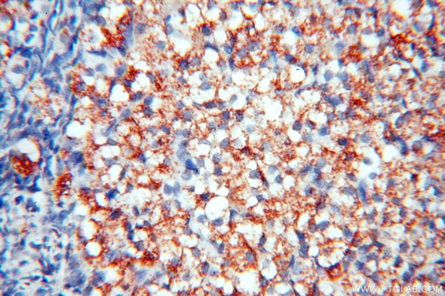 TGM4 Antibody in Immunohistochemistry (Paraffin) (IHC (P))