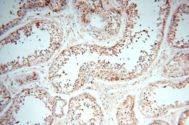 TGM4 Antibody in Immunohistochemistry (Paraffin) (IHC (P))