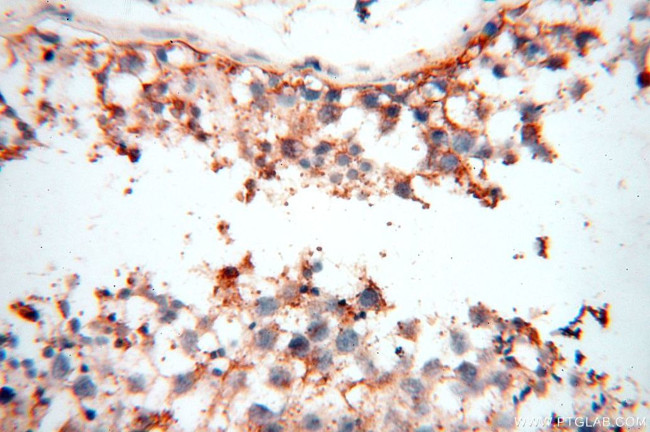 TGM4 Antibody in Immunohistochemistry (Paraffin) (IHC (P))