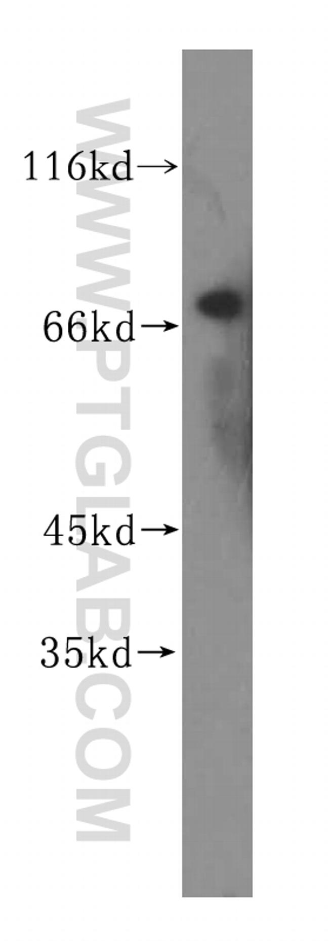 TGM4 Antibody in Western Blot (WB)