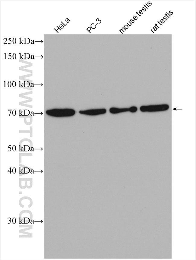 TGM4 Antibody in Western Blot (WB)