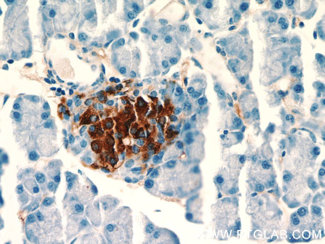 Insulin Antibody in Immunohistochemistry (Paraffin) (IHC (P))