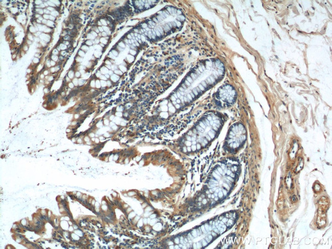 NDUFS4 Antibody in Immunohistochemistry (Paraffin) (IHC (P))