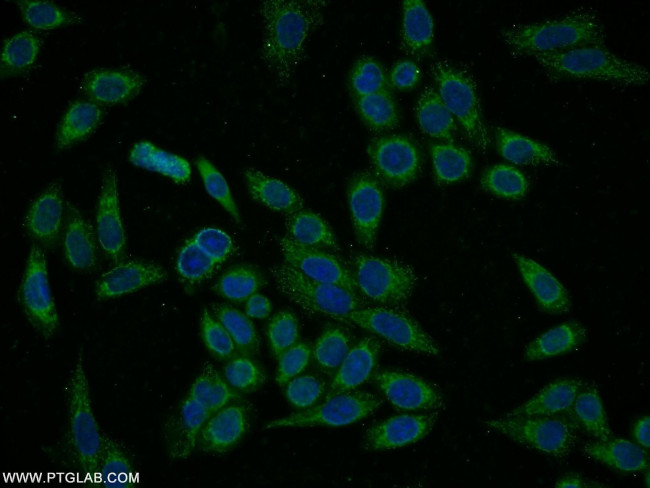 PYGL Antibody in Immunocytochemistry (ICC/IF)