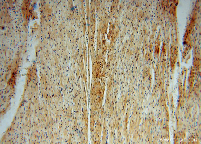 PYGL Antibody in Immunohistochemistry (Paraffin) (IHC (P))