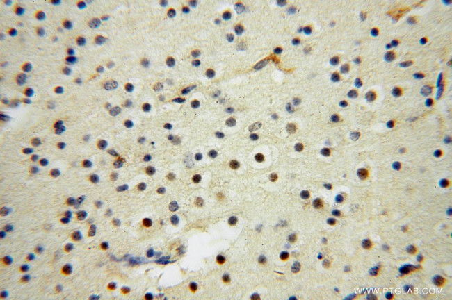 PYGL Antibody in Immunohistochemistry (Paraffin) (IHC (P))