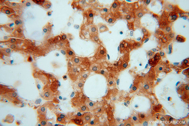 PYGL Antibody in Immunohistochemistry (Paraffin) (IHC (P))