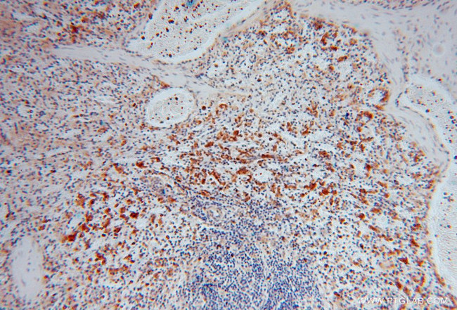 PYGL Antibody in Immunohistochemistry (Paraffin) (IHC (P))