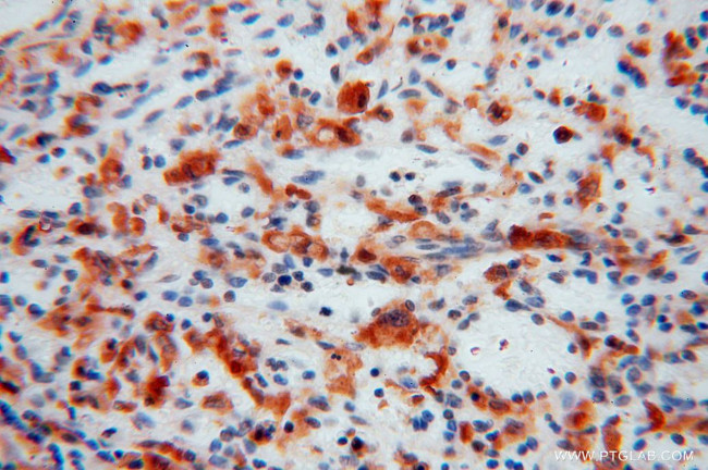 PYGL Antibody in Immunohistochemistry (Paraffin) (IHC (P))