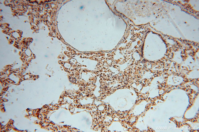 PYGL Antibody in Immunohistochemistry (Paraffin) (IHC (P))