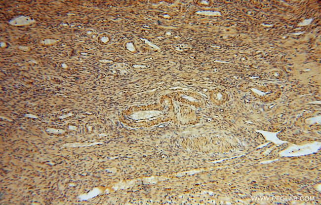 PYGL Antibody in Immunohistochemistry (Paraffin) (IHC (P))