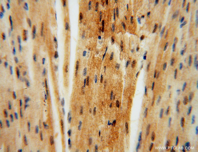 PYGL Antibody in Immunohistochemistry (Paraffin) (IHC (P))