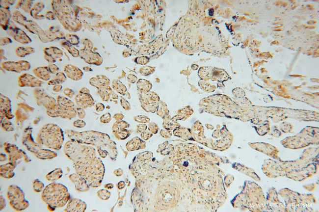 PYGL Antibody in Immunohistochemistry (Paraffin) (IHC (P))