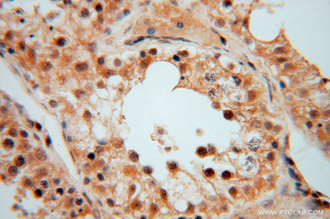 PYGL Antibody in Immunohistochemistry (Paraffin) (IHC (P))