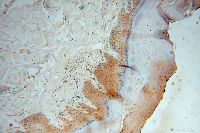 PYGL Antibody in Immunohistochemistry (Paraffin) (IHC (P))