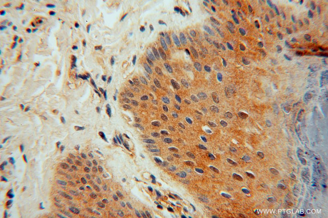 PYGL Antibody in Immunohistochemistry (Paraffin) (IHC (P))